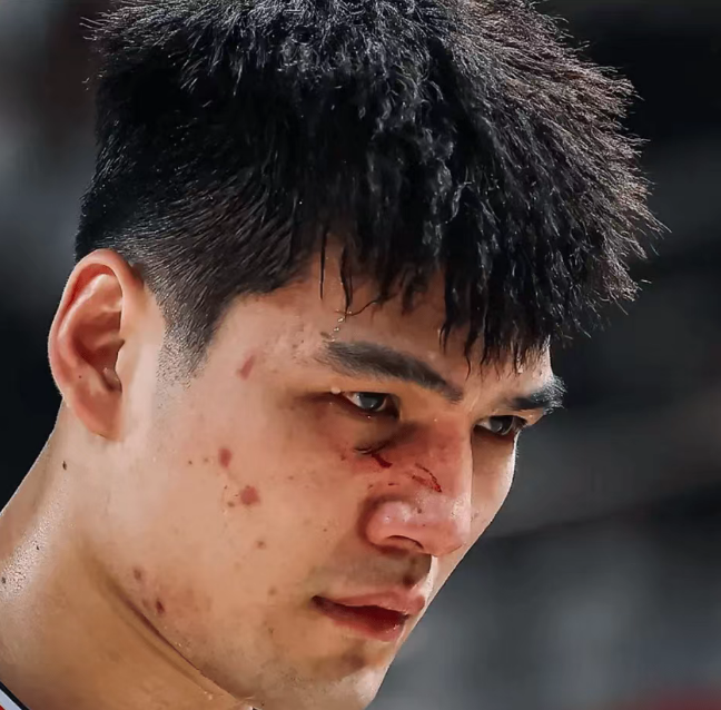 傷痕明顯！廣州狀元陳國豪面部骨裂 季后賽大概率戴面具對陣廣東